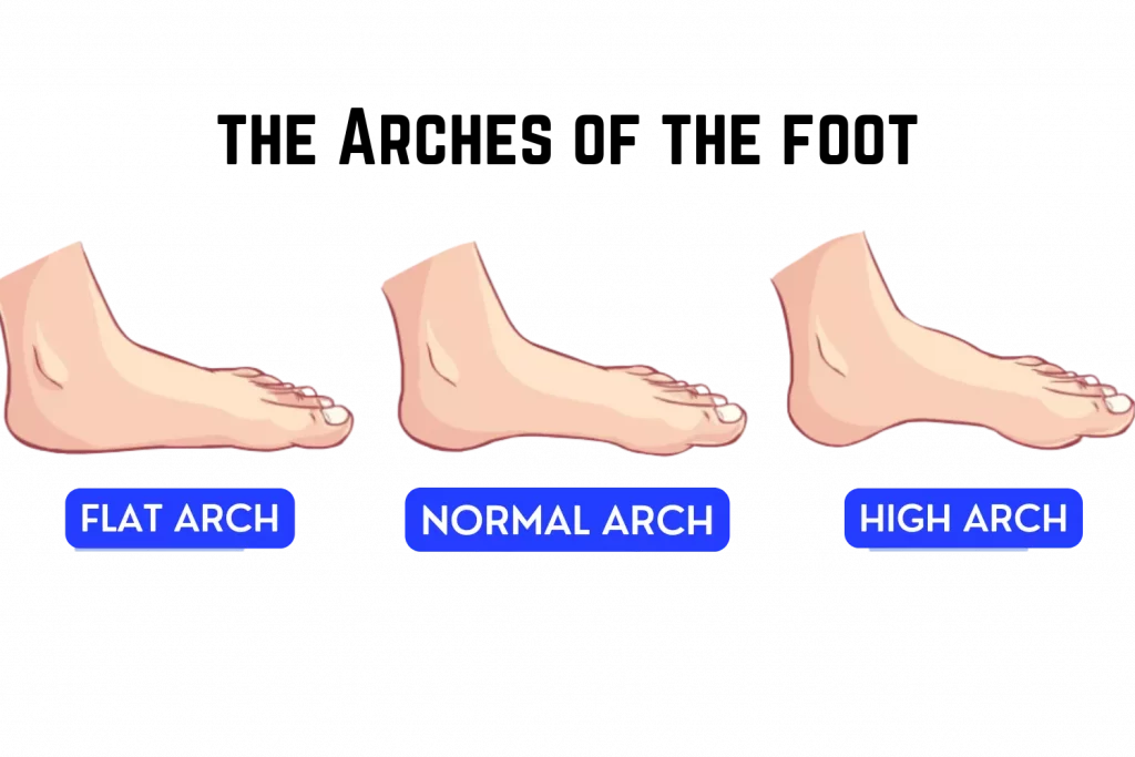 feet arch type determines the arch support for skaters